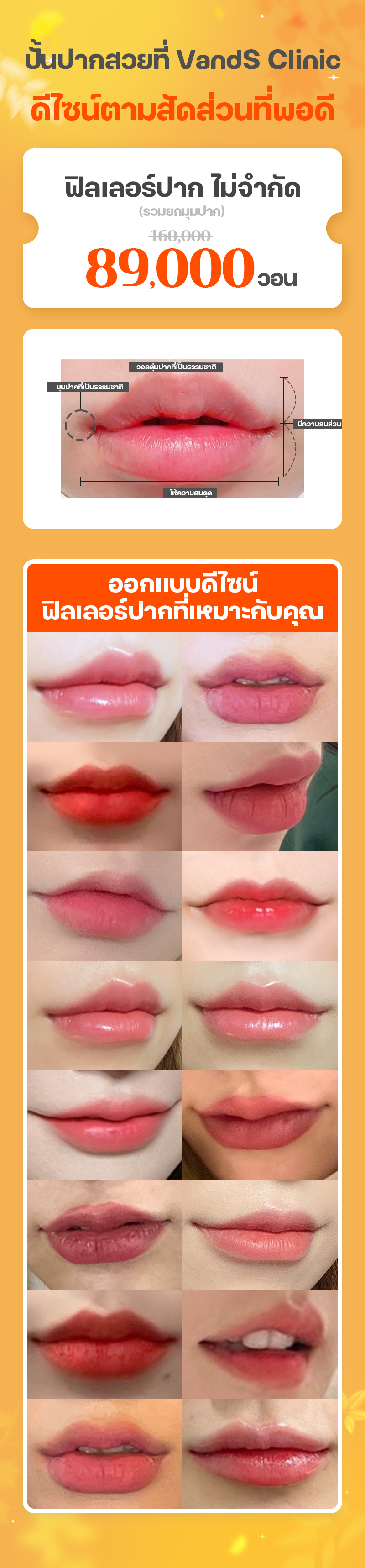 สาขาซองซู ภาพกิจกรรม10