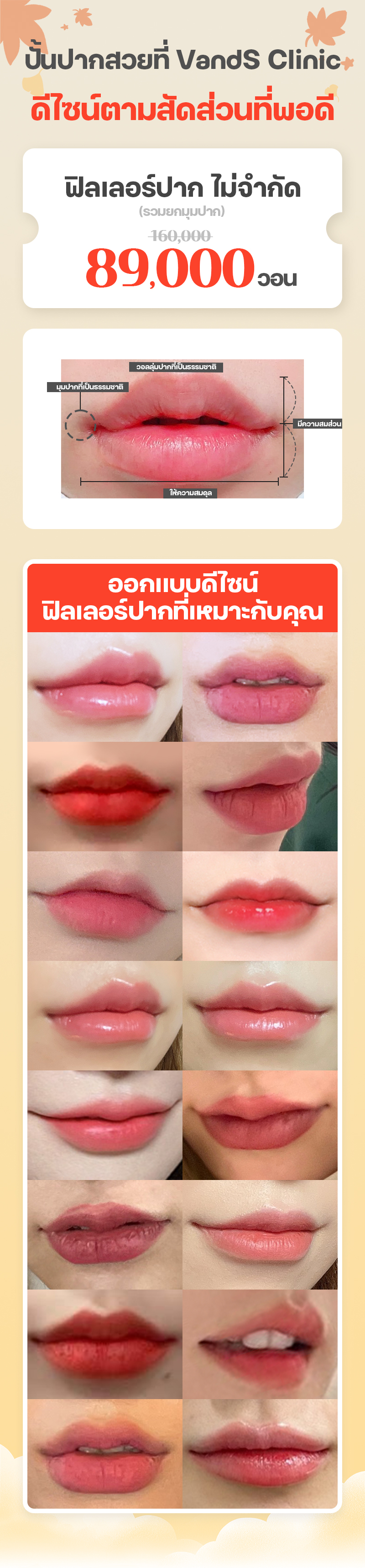 สาขาซองซู ภาพกิจกรรม10